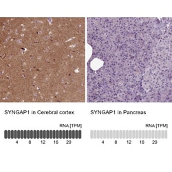 SynGAP Antibody, Novus Biologicals 0.1mL; Unlabeled:Antibodies, Polyclonal